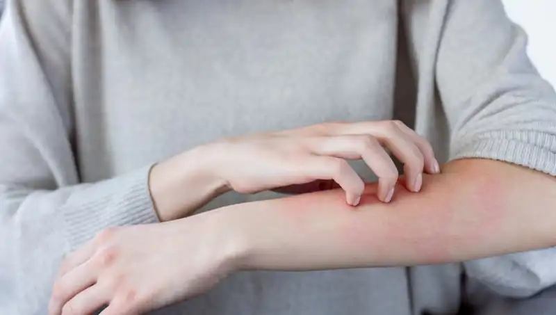 Cilt Kanserinin Gizli Belirtileri: Dermatologdan Şok Edici Açıklamalar