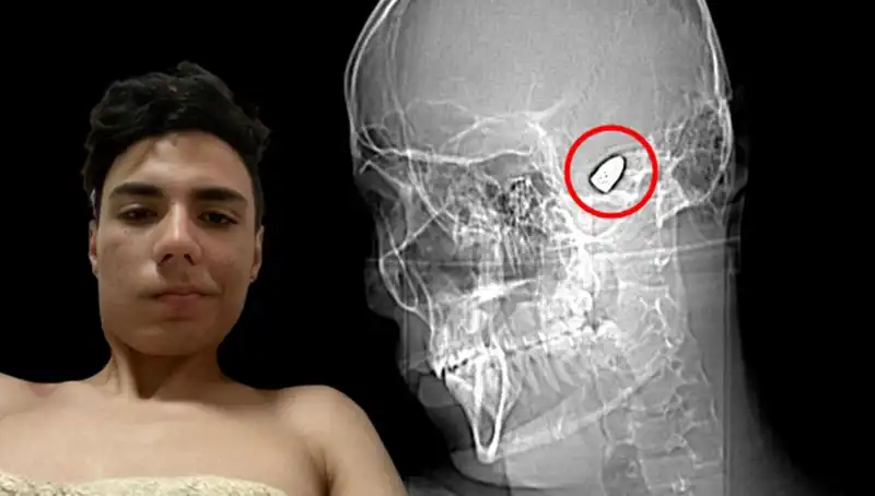 Kafasında Patlayan Düşünceler: Bomba Gibi Bir Zihin Harekete Geçiyor