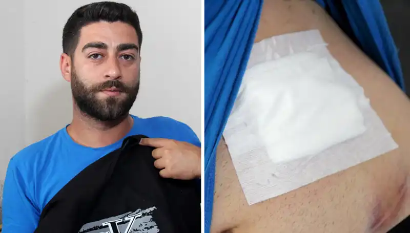 Karnındaki Ağrıların Sebebi Röntgende Ortaya Çıktı: Şok Edici Sonuç!