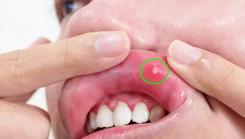 İhmal Edilen Belirtiler Kanserin Early Uyarısına Dönüşebilir mi?